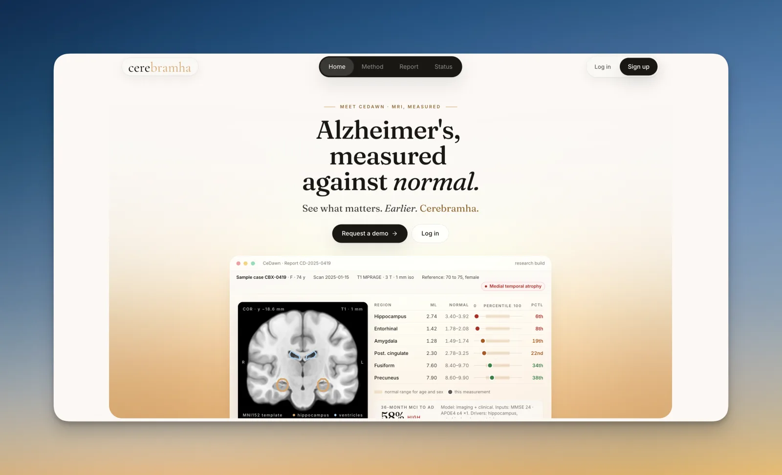 Cedawn report view: regional brain volumes compared against age- and sex-matched normal ranges